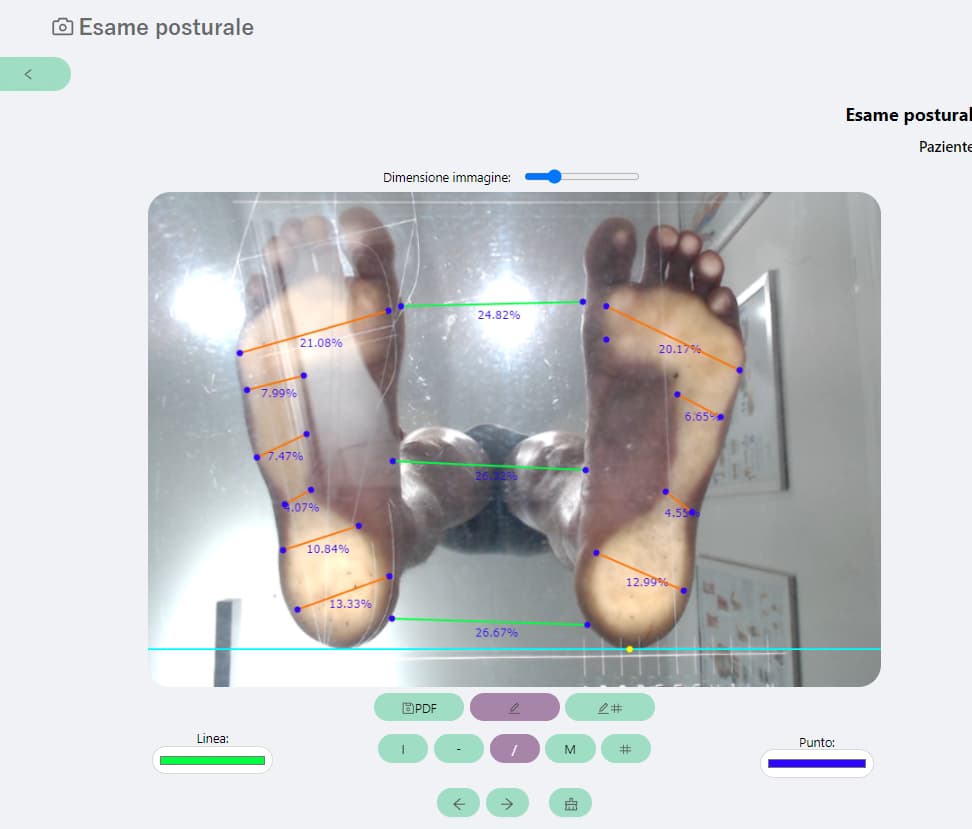 Appoggio Plantare Edit Foto del Software Physiocheck App.